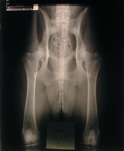 Annie hip xrays at 24 mos