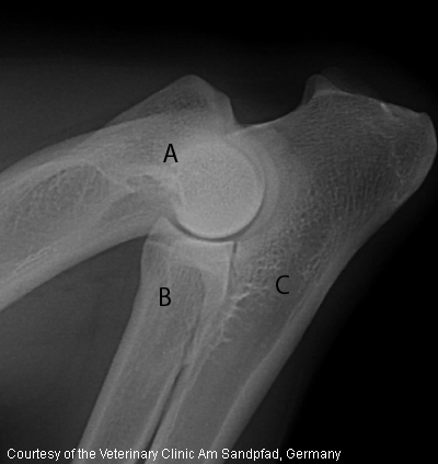 Normal Elbow Joint